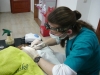 Odstránenie zubného kameňa 2